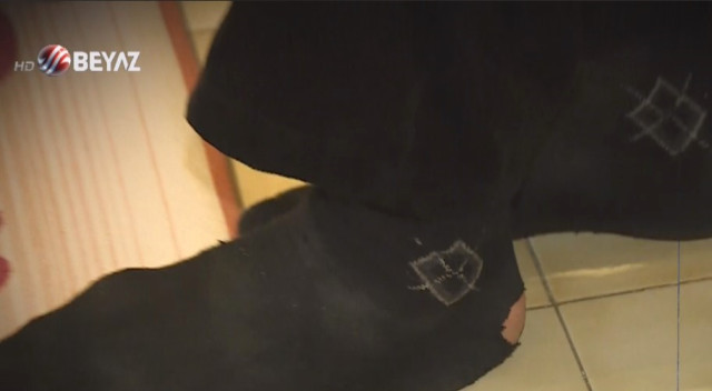 Efsane dizide rol alıyordu! Son hali içler acısı - Resim: 3