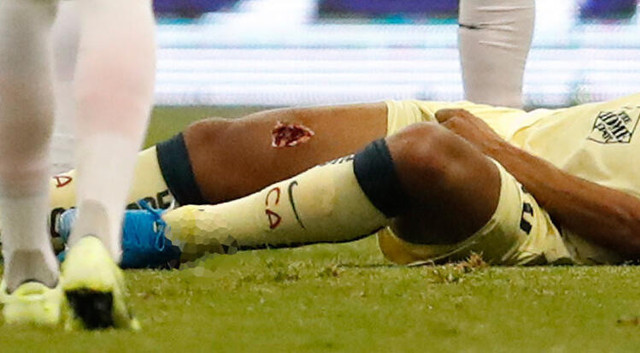 Galatasaray'ın eski futbolcusu Giovani dos Santos çok kötü sakatlandı - Resim: 0