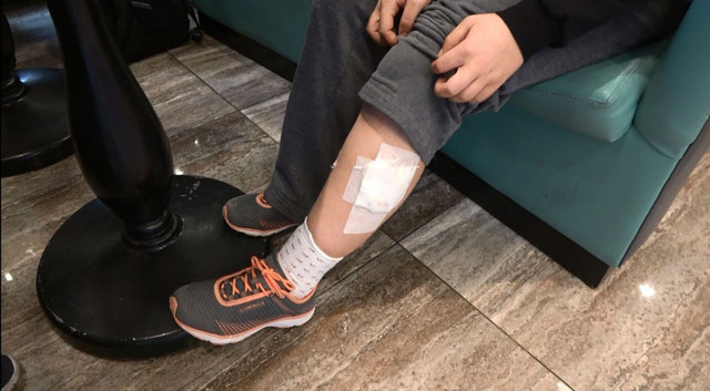 Sultangazi'de başıboş köpekler yolda yürüyen genç kıza saldırıp ısırdı - Resim: 0