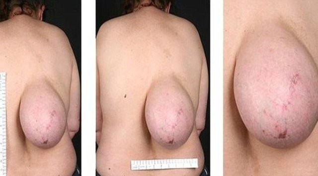 Doktorlar görünce hayrete düştü! Kocaman bir... - Resim: 2