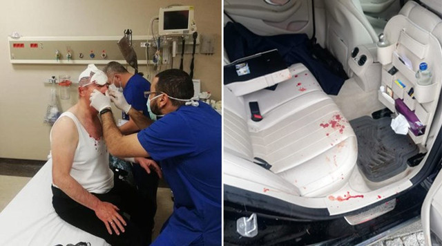 Ahmet Davutoğlu: 24 saat geçti silahlı-sopalı saldırganlar nerede? Azmettirenler nerede? - Resim: 0