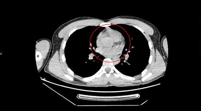 Ankara'da ilginç olay! Rahatsızlanan İranlı yolcunun midesinden 890 gram uyuşturucu çıktı - Resim: 2