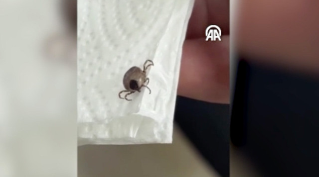 Kulak ağrısı 1 ay ge&ccedil;medi, 5 yaşındaki &ccedil;ocuk hastaneye g&ouml;t&uuml;r&uuml;ld&uuml;, kene ger&ccedil;eği şoke etti - Resim: 0