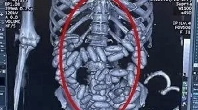 "Yutucu kuryeler" ile dünyayı zehirleyen Türk uyuşturucu baronu teslim oldu - Resim: 0