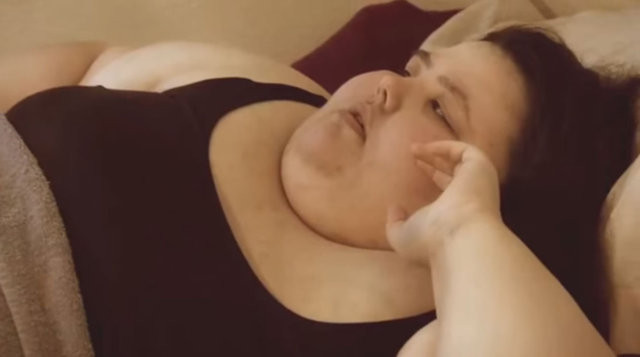 Kiloları yüzünden intihara kalkıştı - Resim: 3