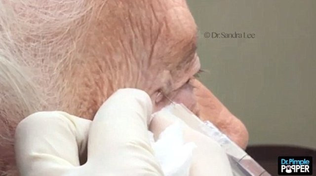 Siyah nokta sanıyordu bakın ne çıktı! - Resim: 4