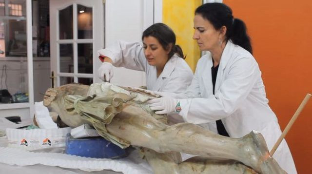 Kalçasından çıkana uzmanlar bile şaşırdı! - Resim: 4