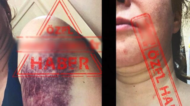 Tansu Çiller'in oğlu Mert Çiller eşini dövdü Zeynep Çiller ifşa etti - Resim: 0