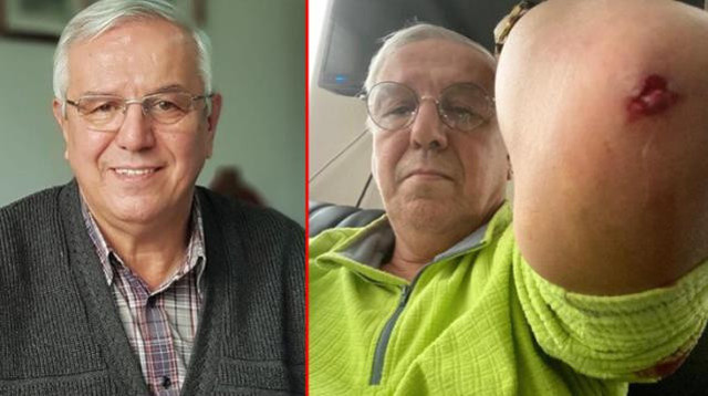 Gazeteci Mehmet Orhan Uğuroğlu'na saldıran zanlılardan 3'ü yakalandı - Resim: 0