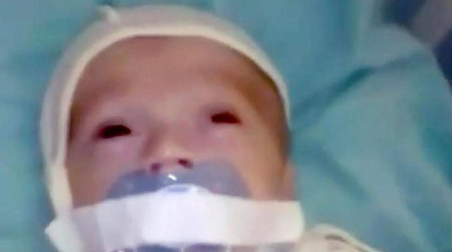 Kuvözdeki bebeğe emzik işkencesi! - Resim: 4