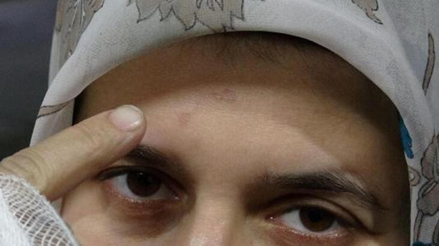 Cezaevi çıkışında gelinlikle karşılamıştı! Dehşeti yaşayan kadın: Beni yakmaya çalıştı - Resim: 1