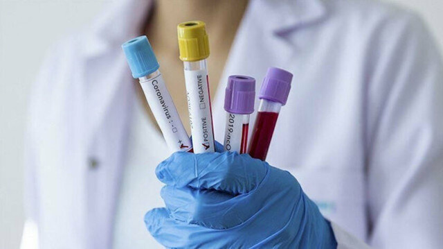 Rusya, 13 ülkeye koronavirüs testi gönderdi! Aralarında İran ve Kuzey Kore de var - Resim: 0