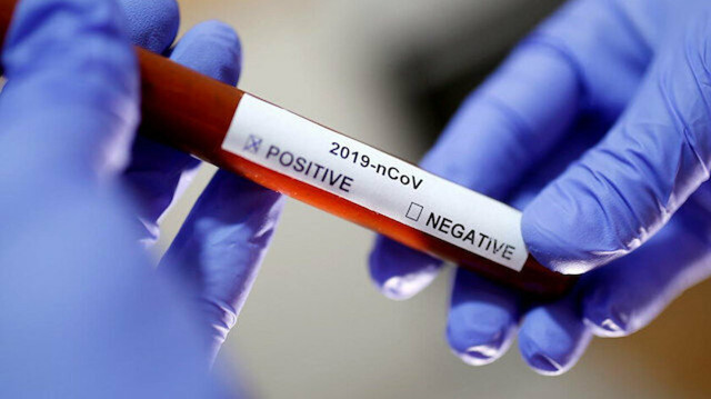 2 milyar doz koronavirüs aşısı dağıtılacak! DSÖ tarih verdi - Resim: 0