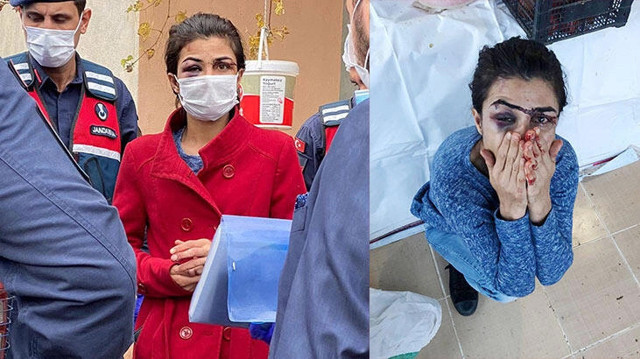 Kendine işkence eden kocasını öldüren Melek İpek örnek oldu YKS'ye girdi kadınlara seslendi - Resim: 0