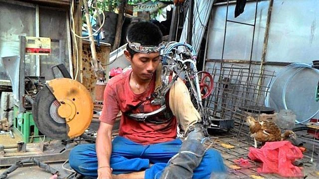 Kendi imkanları ile biyonik kol yaptı - Resim: 4