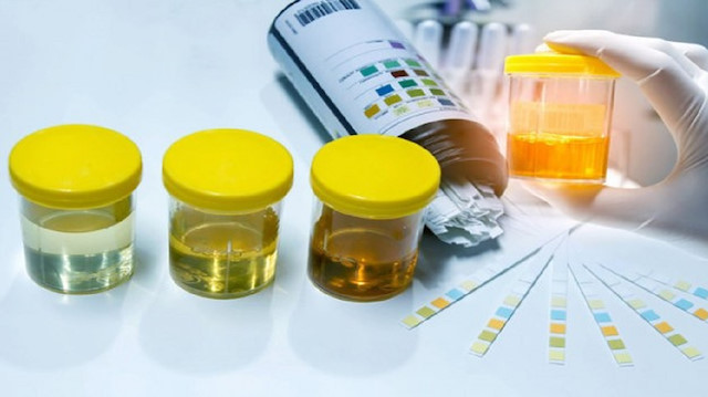 Gerçekliği kanıtlanan ilginç bilgiler! İşaret parmağınız kısaysa - Resim: 2