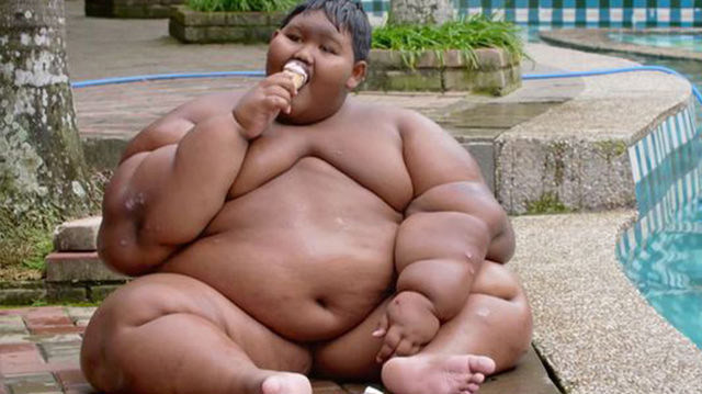 Dünyanın en şişman çocuğuydu! Son hali şaşırttı - Resim: 3
