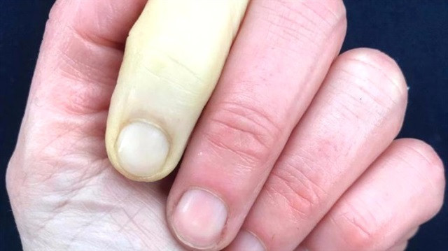 Ünlü sunucu elinin fotoğrafını paylaştı görenler şaştı - Resim: 1