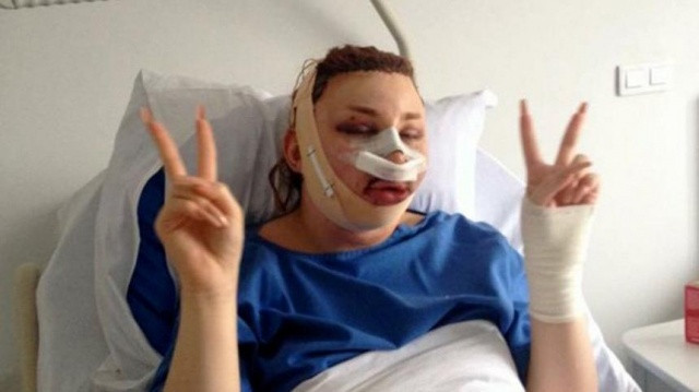 Şişme kadına benzemek için binlerce dolar harcadı! - Resim: 1