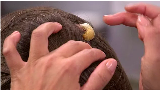 Kafasından boynuz çıktı! Görüntü tıp dünyasını ayaklandırdı! - Resim: 2