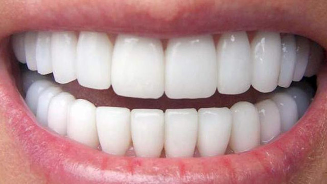 Uzman uyardı! Diş sağlığında kemik kaybı oluşmadan implant yapılmalı - Resim: 1