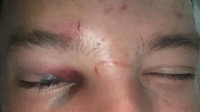 Danny Drinkwater'a çete saldırdı! Biri "Bacaklarını kırın" diyerek talmat verdi - Resim: 1