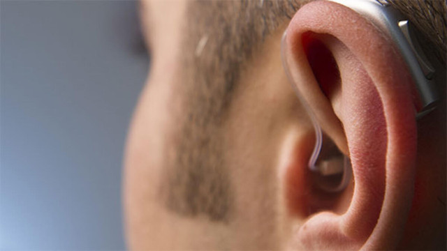 Uzmanı açıkladı: 2050'de 900 milyonu aşkın işitme engelli olacak - Resim: 4