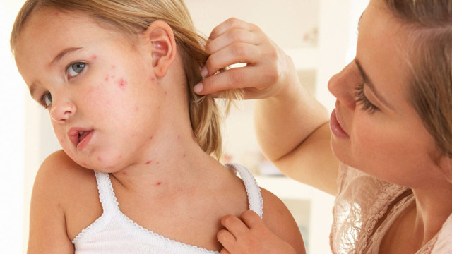 Prof. Dr. Nilgün Atakan: Her 4 kişiden birinde ürtiker hastalığı görülüyor - Resim: 3