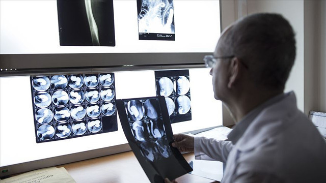 Sağlık Bakanlığı açıkladı! 2 milyon 500 bin kadına meme kanseri taraması - Resim: 0