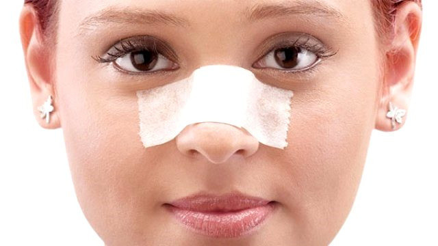 Burun ameliyatı sonrası dikkat edilmesi gerekenler hapşırmaktan korkmayın... - Resim: 2