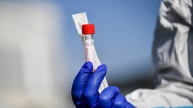 ABD'de yaşayan Türk çift coronavirüs kiti geliştirdi! Testi 3 ila 10 dakikada yapıyor - Resim: 0