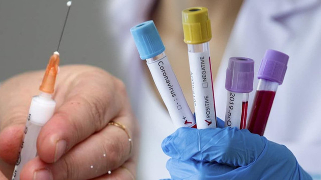 Koronavirüs tedavisinde başarılı olan ilaç neden toplatıldı? Fahrettin Koca açıkladı - Resim: 0