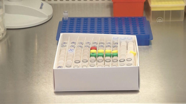 Şok gelişme! İngiltere'nin Çin'den ithal ettiği tanı kitlerinde koronavirüs tespit edildi - Resim: 0