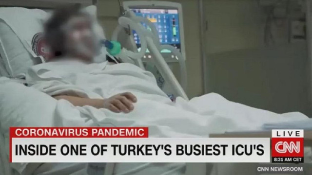 CNN en kritik yoğun bakıma girdi! Gördükleri ile adeta şok oldu - Resim: 0