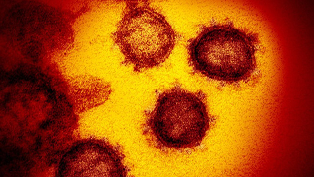 Kovid-19 virüsü artık Wuhan'dakinden daha bulaşıcı! ABD'deki araştırma ortaya çıkardı - Resim: 0