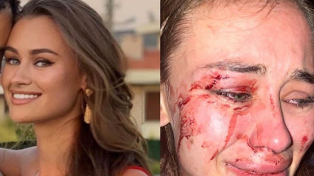 Çeşme'de darp edilen manken olayı! Bakan Ersoy: Kimsenin yanına kar kalmayacak - Resim: 1