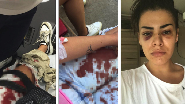 Nagehan Bıyıklı'ya önce taciz sonra darp: Korkudan eve gidemiyorum - Resim: 2