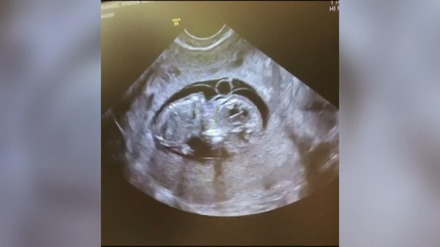 İngiltere'de yaşandı: Eşcinsel çift bebek sahibi oldu - Resim: 2