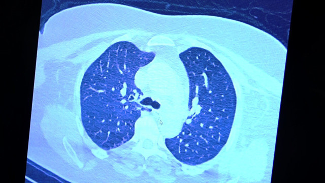 Fark ortaya çıktı! Koronavirüslü hastalarının görüntüsü görenleri şok etti - Resim: 2