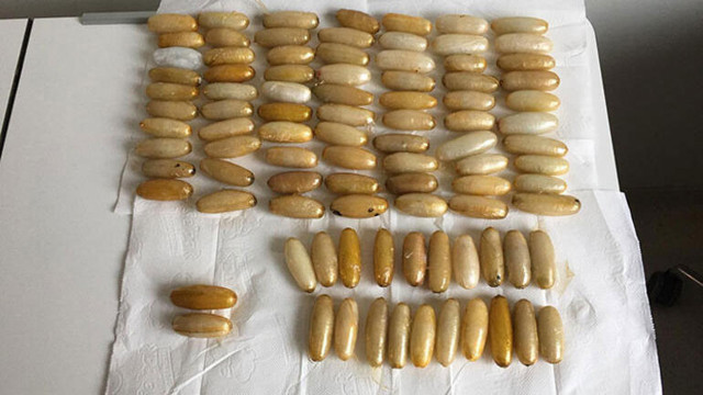 Midesinden 1 milyonluk uyuşturucu çıktı! - Resim: 1