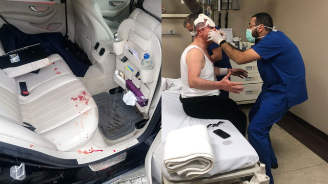 Selçuk Özdağ'a saldırı iddianamesi! 5 şüpheli hakkında 11 yıl 9'ar aya kadar hapis istemi - Resim: 0