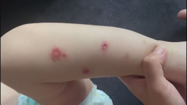 Sizin gibi anne baba olmaz olsun! Şişli'de 2 yaşındaki çocuğa işkencenin detayları - Resim: 1