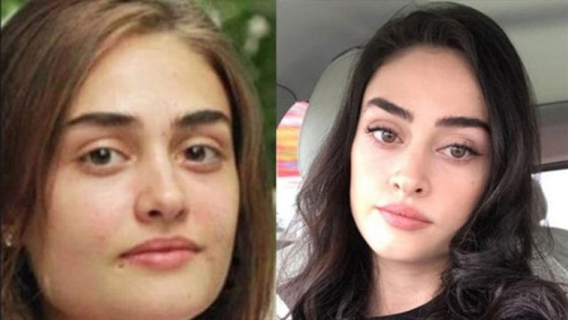 Esra Bilgiç evli mi aslen nereli? Esra Bilgiç eski estetiksiz hali nasıldı? - Resim: 0