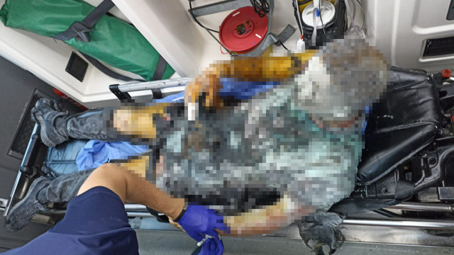 Galata Kulesi'nde gözler önünde kendini yakan adamdan acı haber - Resim: 0