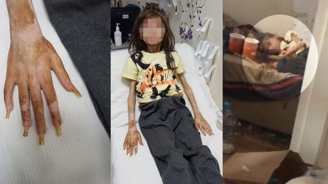 Bursa'da çöp evde bulunan Cem Muhammet'ten yeni görüntüler geldi - Resim: 2