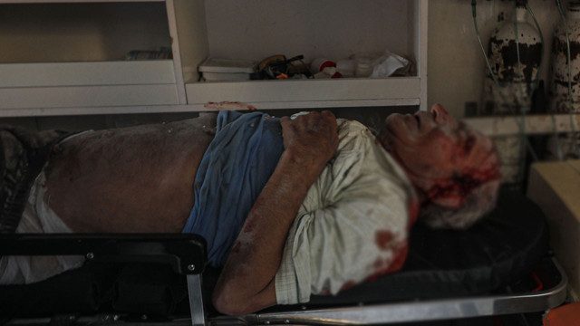 İsrail Gazze Şeridi'ni vurdu: Çok sayıda ölü var yaralı var - Resim: 1