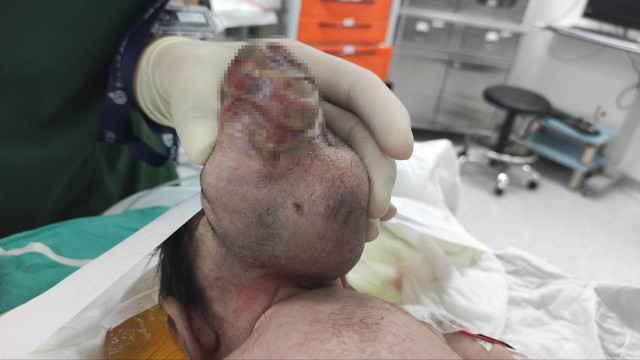 Beyninin yarısı kafatası dışında doğdu! Kahramanmaraş'ta bebeği görenler şaşırıyor - Resim: 1