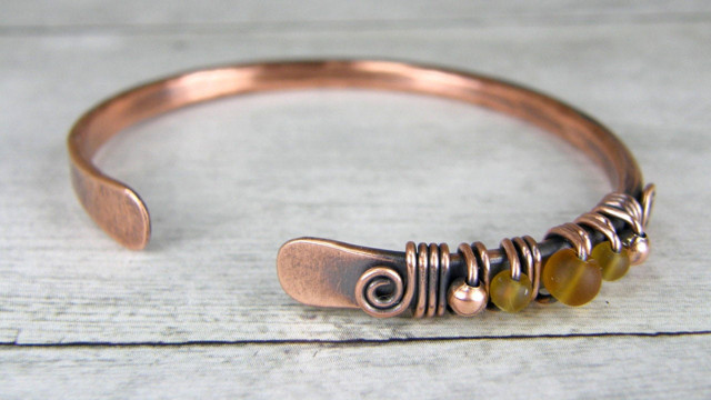 Bir ara herkes takardı bakır bileziğin gerçekten iyileştirme özelliği varmış ama bu oluyorsa... - Resim: 1