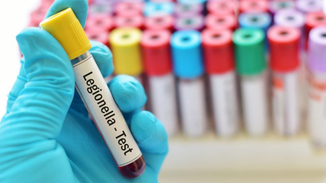 Klinikte büyük kabus! 6 kişiyi öldürdü! 'Legionella' nasıl bulaşıyor? Bu belirtilere dikkat... - Resim: 0