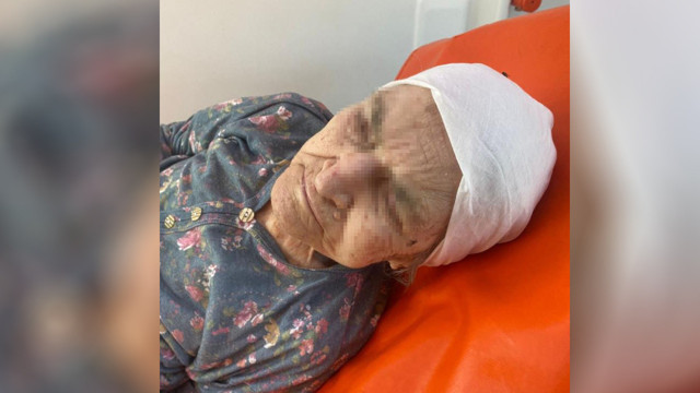 Alzheimer hastası anneye acımasız yumruklar! Kız kardeşi isyan etti: Canımıza yetti - Resim: 0